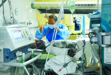 11岁女孩掉进沸腾大锅烫伤 母亲割皮救女儿(图)