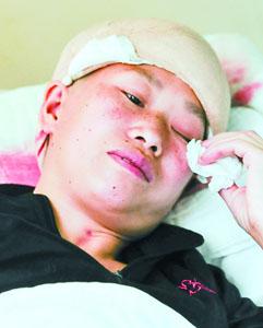 11岁女孩掉进沸腾大锅烫伤 母亲割皮救女儿(图)