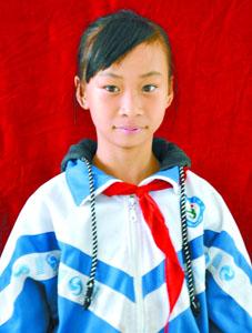 11岁女孩掉进沸腾大锅烫伤 母亲割皮救女儿(图)