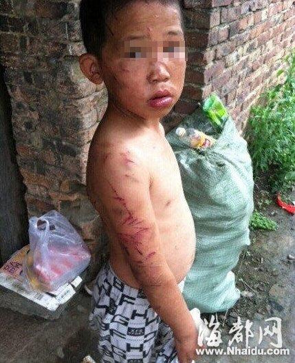 九岁男孩长期遭母亲虐打 邻居半夜常闻惨叫