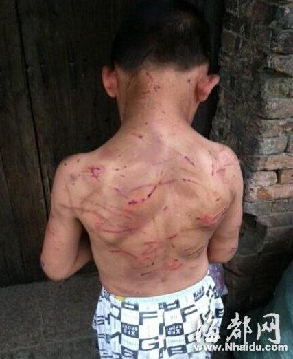 九岁男孩长期遭母亲虐打 邻居半夜常闻惨叫