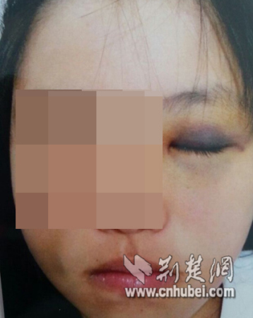 网曝湖北长阳教师打女生网友发帖:比土匪还凶(图)