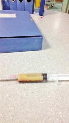 男子大吃大喝 去医院抽血抽出半管油