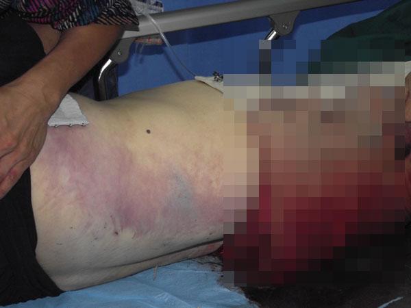 福州女子被山东铁警跨省调查后死亡 身上有淤青