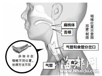 九岁男童吃牛排骨头卡喉 延误抢救时机身亡(图)