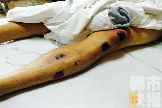 陕西高校老师偷拍女生洗澡 被打成重伤生命垂危