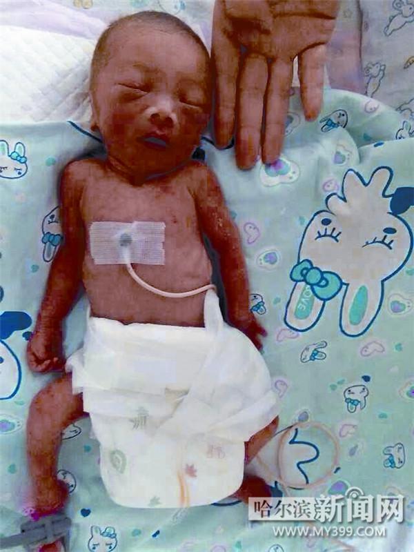 哈尔滨两斤重赤身早产女婴被遗弃垃圾桶(图)