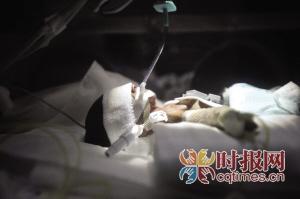 重庆产妇生下袖珍宝宝 体重1.3斤仅有筷子长