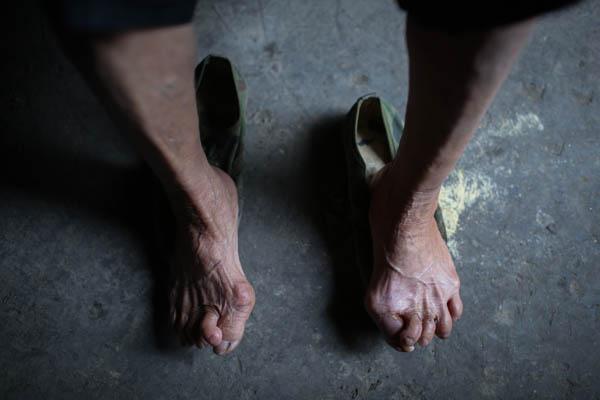 广西村庄被重金属污染 村民体检报告封存9年