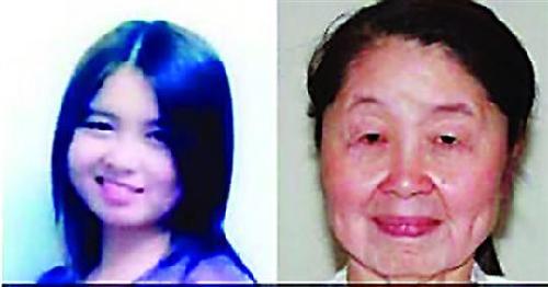 28岁女子患罕见皮肤松弛怪病 “一夜”变老妪