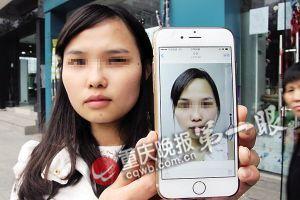 女子万元割双眼皮被整成高低眉 院长称效果挺好