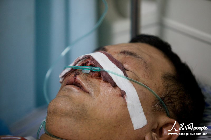 12月30日，深圳龙岗区六约社区麻地村民陈锦华在埔厦路一柜员机取完钱之后被三名刀手围砍身中十多刀，取的钱散落一地刀手却分文未取。此前他曾经实名举报过村官。王子荣/CFP