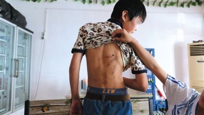 北京3人围殴14岁少年近9分钟 搬石块砸其背部【4】