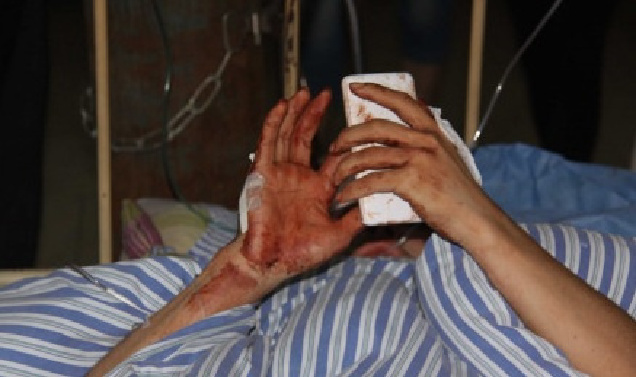 宜春遇砍人夺刀救人少年无缘高考