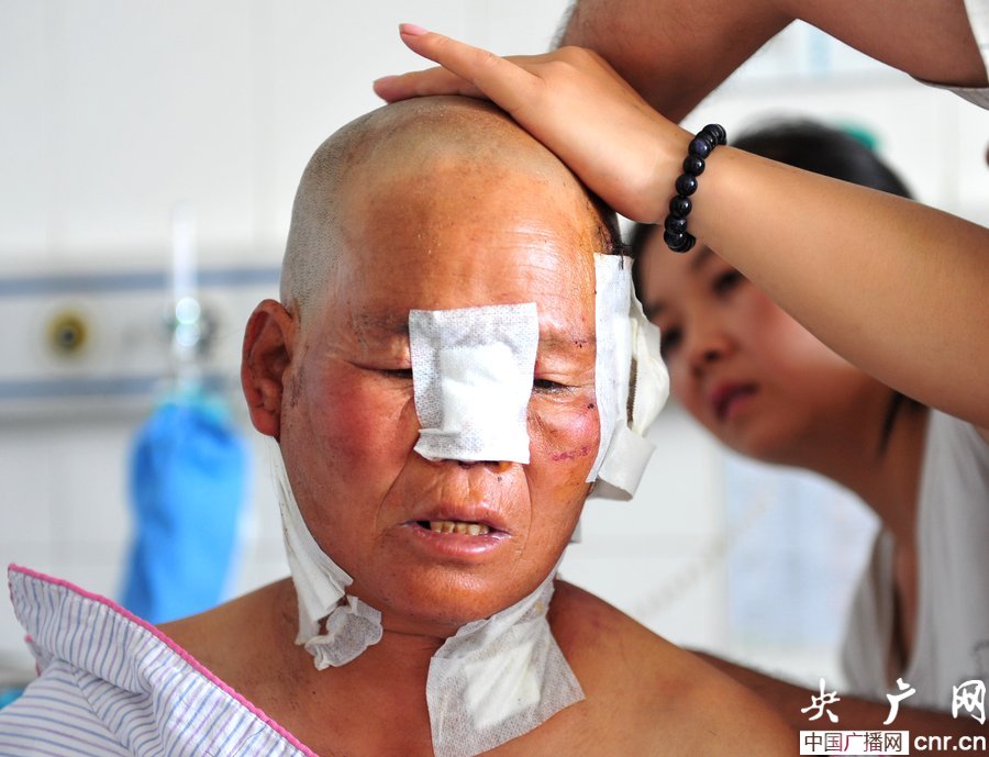 新疆发生狼群袭人事件 6人受伤1人耳朵被咬掉