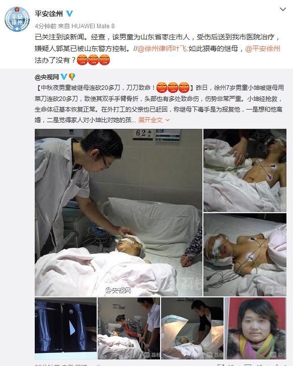 男童被继母连砍20多刀 警方:嫌疑人已被控制